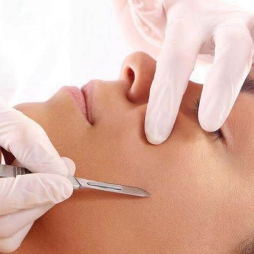 Chill Beauty Dermaplaning